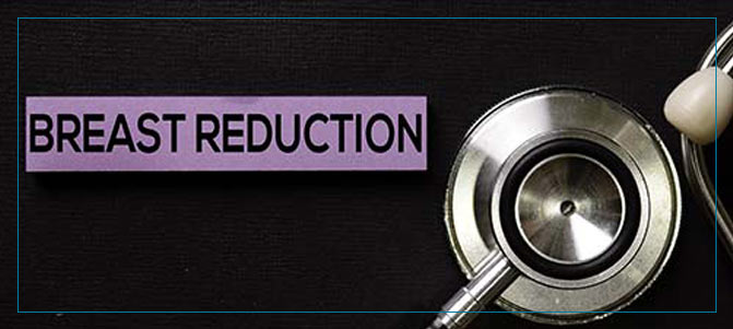 Benefits of Breast Reduction Surgery Q&A