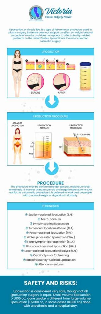Liposuction is a type of aesthetic procedure that uses suction to get rid of deposits of fat from the body to enhance the look and smooth out uneven body shapes that diet and exercise haven't been able to eliminate. Dr. Suh is dedicated to providing all of her patients with exceptional liposuction procedures to help them remove unwanted fats from their bodies. For more information, contact us or simply request an appointment online. We are conveniently located at 8503 Arlington Blvd #130 Fairfax, VA 22031.