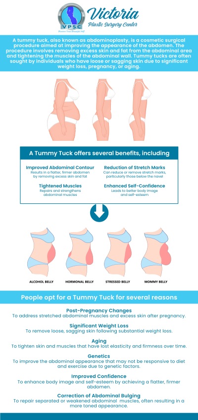 A tummy tuck, also known as abdominoplasty, is a surgical procedure that helps in improving the appearance of the abdomen by removing excess skin and fat and tightening the underlying muscles.  Dr. Suh at Victoria Plastic Surgery provides tummy tuck surgery procedures for those looking to remove excess fat and have a smooth firm abdomen. For more information, please contact us or book an appointment online. We are conveniently located at 8503 Arlington Blvd #130 Fairfax, VA 22031. 