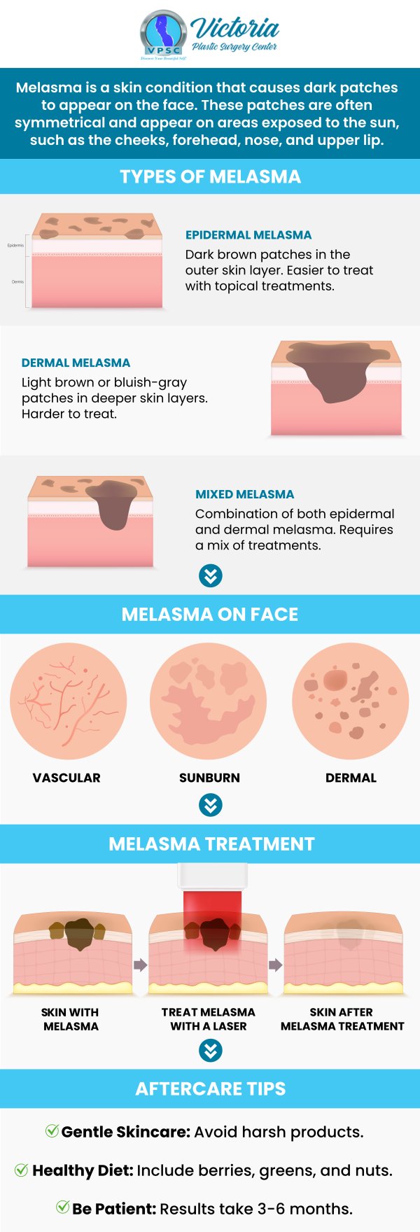Melasma can be uncomfortable to anyone dealing with it and can cause feelings of discomfort in your skin. Meet Dr. Suh at Victoria Plastic Surgery Center today for our Melasma Treatment to lighten the color of melasma on your skin and see your self-esteem and confidence rise again! For more information, please contact us or book an appointment online. We are conveniently located at 8503 Arlington Blvd #130 Fairfax, VA 22031. Melasma can be uncomfortable to anyone dealing with it and can cause feelings of discomfort in your skin. Meet Dr. Suh at Victoria Plastic Surgery Center today for our Melasma Treatment to lighten the color of melasma on your skin and see your self-esteem and confidence rise again! For more information, please contact us or book an appointment online. We are conveniently located at 8503 Arlington Blvd #130 Fairfax, VA 22031.