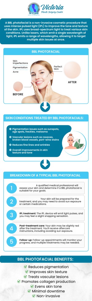 BroadBand Light Therapy is an FDA-approved anti-aging treatment that treats UV damage, uneven skin texture and tone, fine lines, and wrinkles. It uses brief episodes of high-intensity light to firm up, level up, and rejuvenate your skin. BBL is a rapid in-office procedure for skin rejuvenation because there is no surgery involved. Visit Dr. Suh, our board-certified plastic surgeon at Victoria Plastic Surgery Center, for consultation and treatment. For more information, contact us or schedule an appointment online. We are conveniently located at 8503 Arlington Blvd #130 Fairfax, VA 22031. BroadBand Light Therapy is an FDA-approved anti-aging treatment that treats UV damage, uneven skin texture and tone, fine lines, and wrinkles. It uses brief episodes of high-intensity light to firm up, level up, and rejuvenate your skin. BBL is a rapid in-office procedure for skin rejuvenation because there is no surgery involved. Visit Dr. Suh, our board-certified plastic surgeon at Victoria Plastic Surgery Center, for consultation and treatment. For more information, contact us or schedule an appointment online. We are conveniently located at 8503 Arlington Blvd #130 Fairfax, VA 22031.