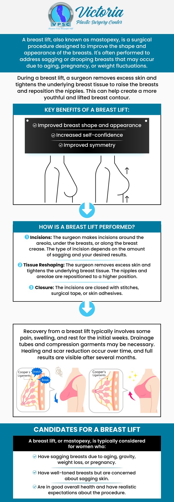 Breast lift surgery, performed by Dr. Suh, MD, at Victoria Plastic Surgery Center, offers numerous benefits, including improved breast shape, enhanced firmness, and a more youthful appearance. This procedure can restore your confidence by lifting and reshaping sagging breasts, providing a more contoured and natural look. Dr. Suh's expertise ensures personalized care and exceptional results tailored to your needs. For more information, please contact us or book an appointment online. We are conveniently located at 8503 Arlington Blvd #130 Fairfax, VA 22031.