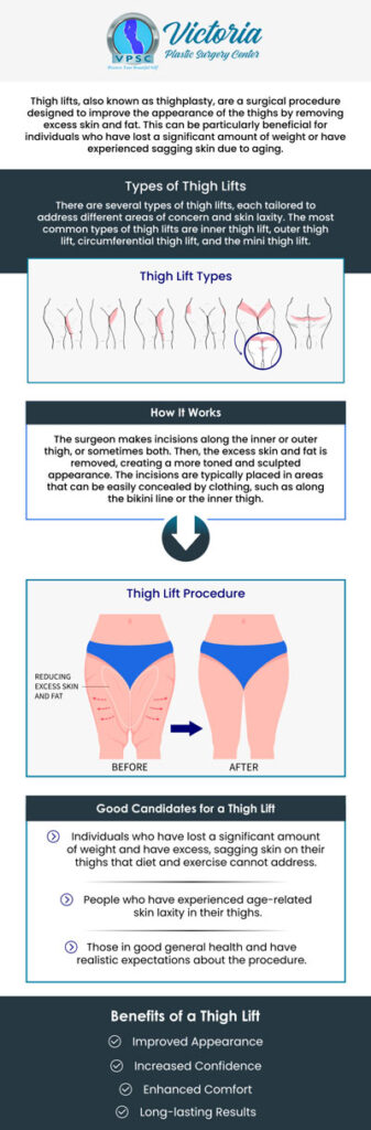 Thigh lift surgery, also known as thighplasty, is a cosmetic surgical procedure designed to reshape and contour the thighs by removing excess skin, tightening underlying tissues, and reducing sagging. Meet Dr. Suh and get rid of sagging skin around your thighs with thigh lift surgery at Victoria Plastic Surgery Center. For more information, contact us or request an appointment to talk to a specialist. Visit us today at 8503 Arlington Blvd #130 Fairfax, VA 22031.