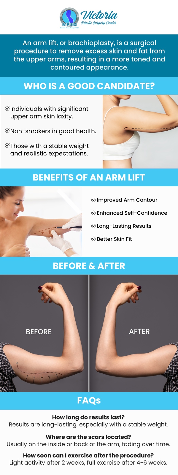 For a more sculpted and toned appearance, arm contouring surgery at Victoria Plastic Surgery Center, led by Dr. Suh, MD, effectively removes excess skin and fat. This procedure enhances the definition of your upper arms, providing a smoother, firmer look. Dr. Suh tailors each treatment to ensure optimal results and improved confidence. For more information contact us or simply request an appointment online. We are conveniently located at 8503 Arlington Blvd #130 Fairfax, VA 22031. For a more sculpted and toned appearance, arm contouring surgery at Victoria Plastic Surgery Center, led by Dr. Suh, MD, effectively removes excess skin and fat. This procedure enhances the definition of your upper arms, providing a smoother, firmer look. Dr. Suh tailors each treatment to ensure optimal results and improved confidence. For more information contact us or simply request an appointment online. We are conveniently located at 8503 Arlington Blvd #130 Fairfax, VA 22031.